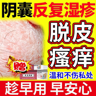 阴囊湿疹瘙痒脱皮干燥潮睾丸湿起皮干裂蛋蛋皮痒男人士红肿裂口OZ