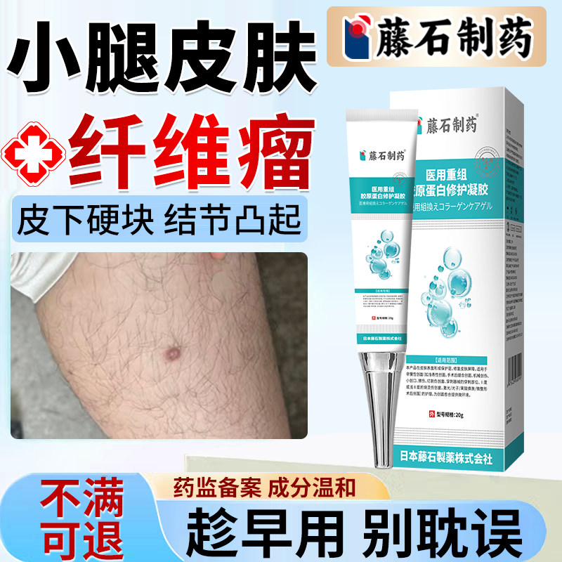 腿上皮肤纤维瘤小硬疙瘩纤维硬块肉瘤消瘤去除搭药房同款膏神器DZ