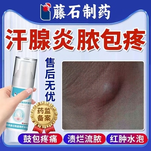 腋下囊长脓包肿化脓性大汗腺炎腋窝湿疹消伤口炎软膏药房同款膏EM