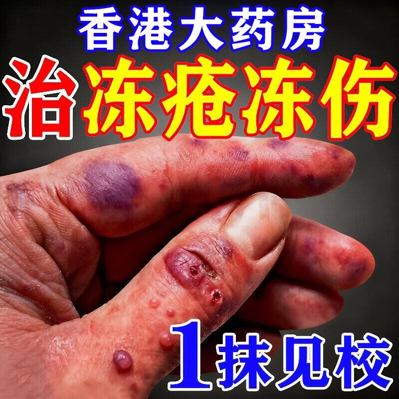 冻疮特效膏药护手霜冻疮膏止痒冻伤膏药膏排行榜名耳朵修复膏