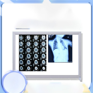 超薄X光观片灯箱医护led看片灯箱阅片灯三联看观片灯双联骨科核磁