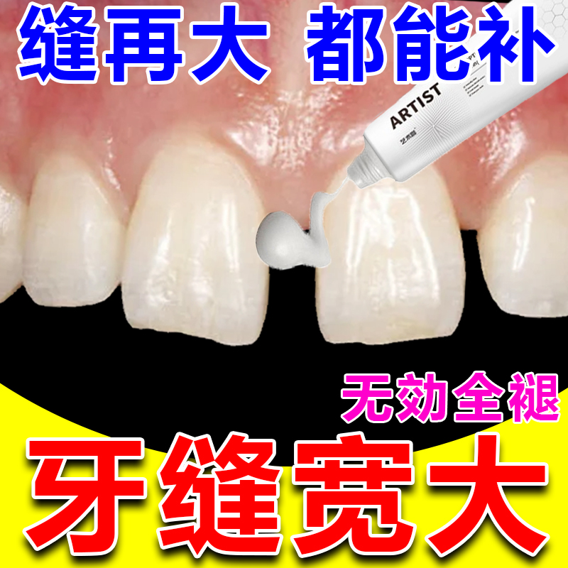 牙缝宽大修复神器补牙缝牙膏填充门牙牙缝大矫正防堵蛀牙牙洞清理