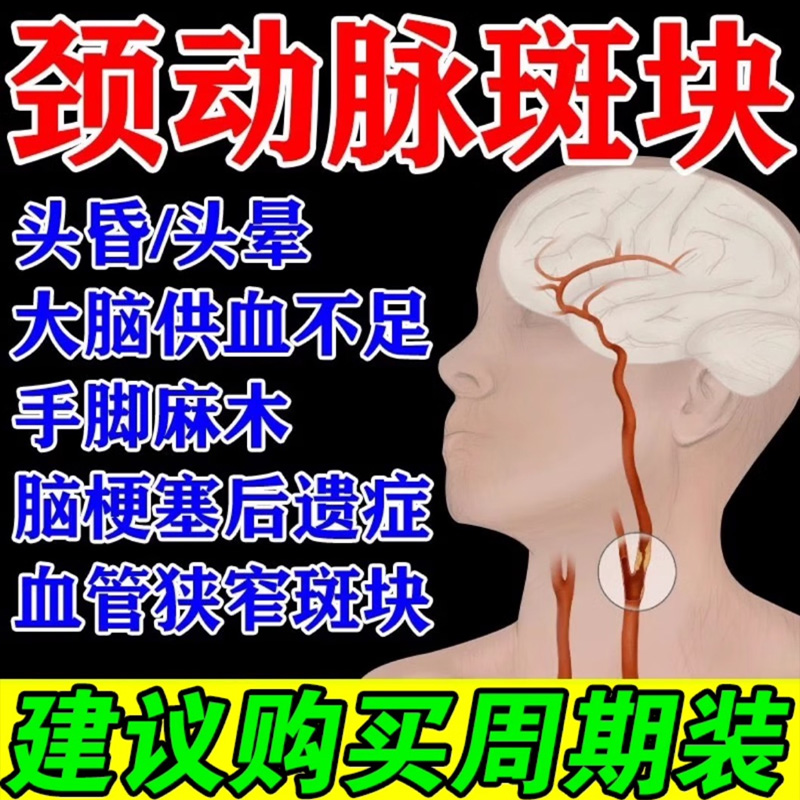 消除颈动脉斑块药血管堵塞狭窄大脑供血不足疏通软化硬化头晕头昏