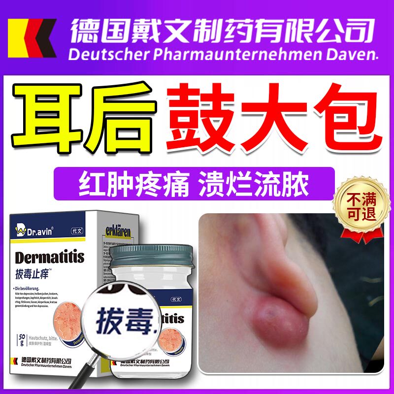 耳朵后面长疙瘩皮脂腺囊肿专用皮肤纤维瘤贴疖肿拔毒膏药房有售yr