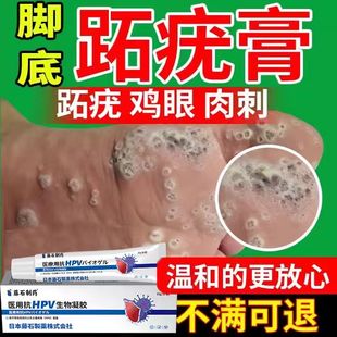 跖疣专用膏去病毒疣连根脚上长足部根拔贴脚底去除石拓跎疣蚩尤EM