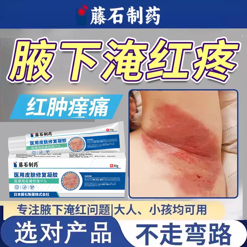 腋下淹红腋窝胳肢窝淹了成人痱可搭子粉湿防脖子疹红痒肿疼出汗OZ,保健用品,皮肤消毒护理（消）,淘宝优惠券,粉丝福利购,淘宝优惠卷