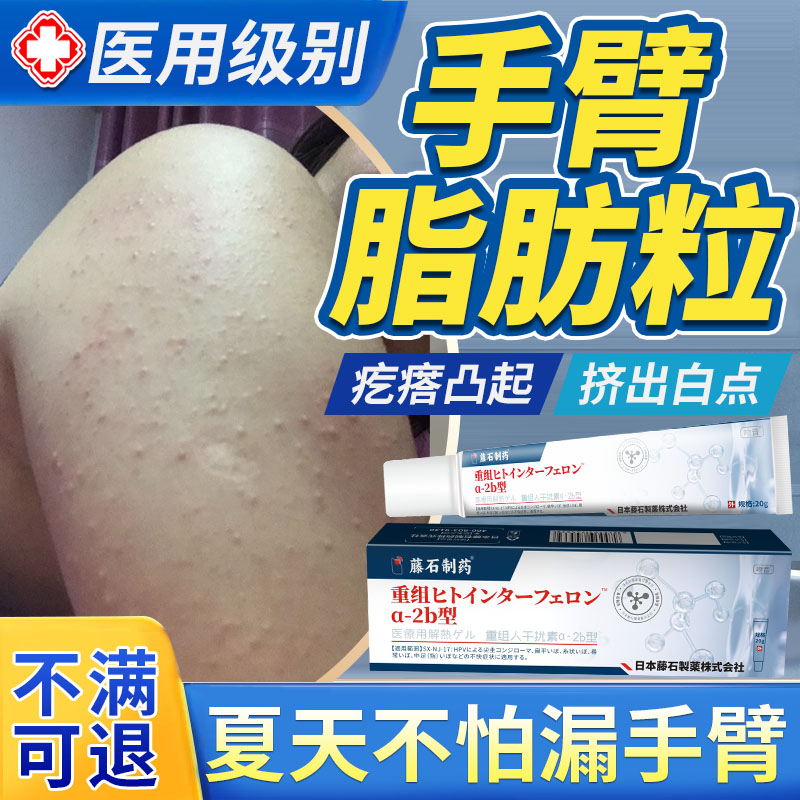 手臂脂肪粒去除神器长小颗粒去鸡皮疙瘩毛囊角化药房同款膏儿童yr