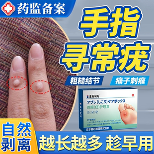 手上长硬疙瘩寻常疣膏去除甲周疣根刺猴瘊子神器薬房同款专用贴JW