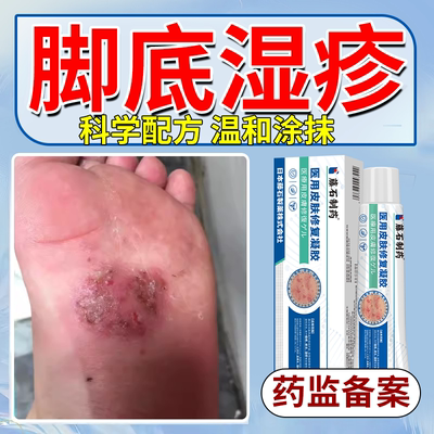 【脚底湿疹】干燥脱皮水泡瘙痒