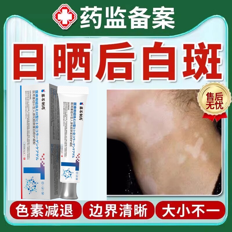 日晒后白斑日光性色素减退肤色软膏脸上白癜风伤皮肤快速专用消DZ
