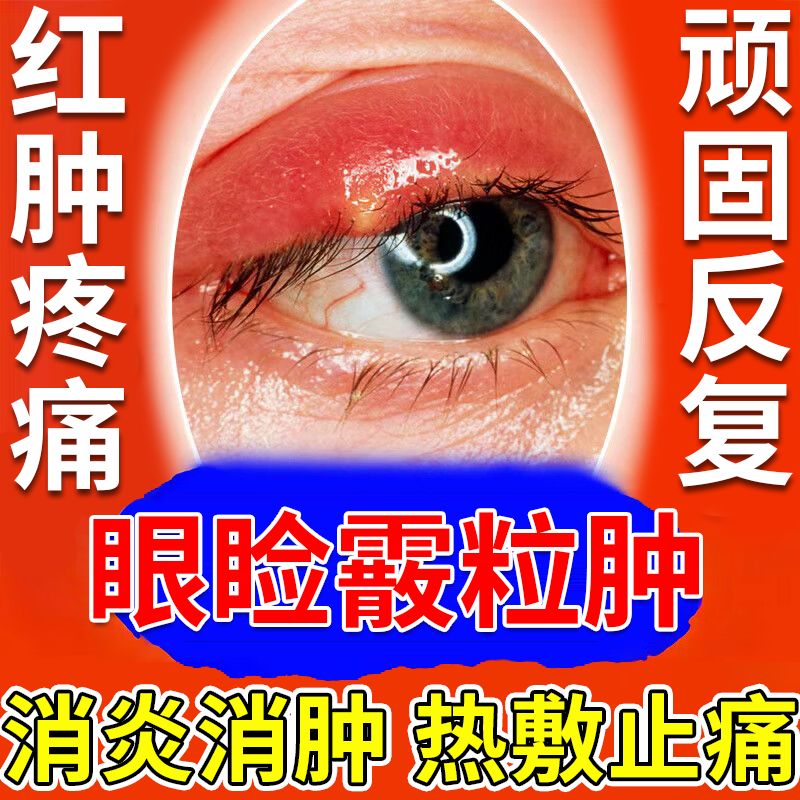 消消眼睑红肿止痛【不满可退】