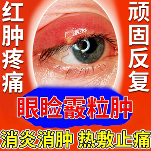 霰粒肿麦粒肿眼睑板堵塞散粒肿儿童眼部医用热敷眼贴皮蒸汽眼罩DZ