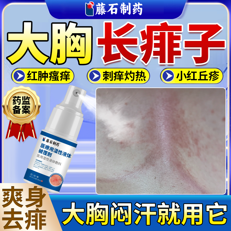 大胸女士出汗长痱子药膏去痱止痒乳房湿疹可搭成人痱子粉爽身粉EM