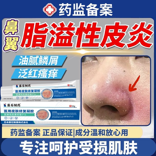 鼻翼脂溢性皮炎鼻子两侧发红脱皮鼻翼两边泛红干燥起皮面部面霜EM