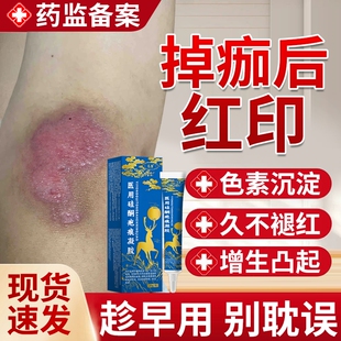 掉痂后去红印黑色素沉淀修复膏退红淡印面部擦伤摔伤疤痕除疤膏JW