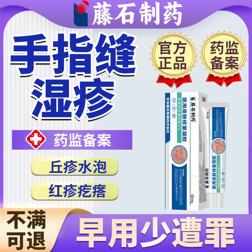 【手指缝糜烂红痒】真菌感染