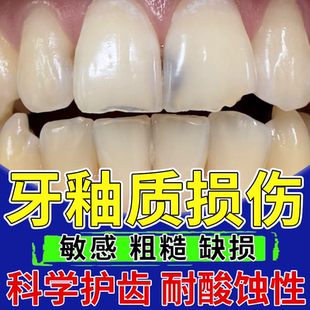 牙釉质损伤修复膏可搭牙膏修补液抗敏感修护牙齿脱矿专用再矿化OZ