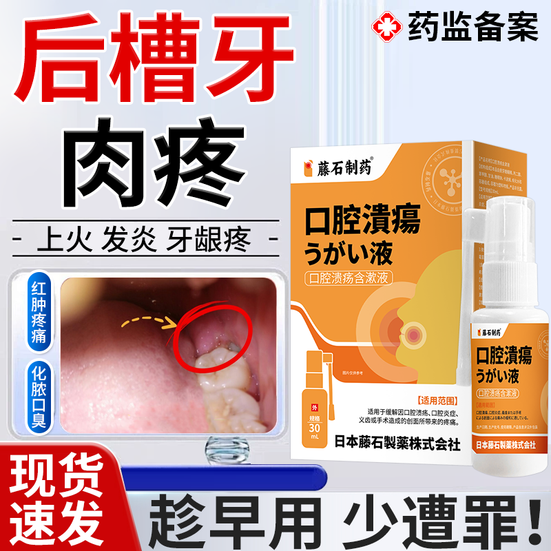 【现货速发】后槽牙肉疼止疼喷剂