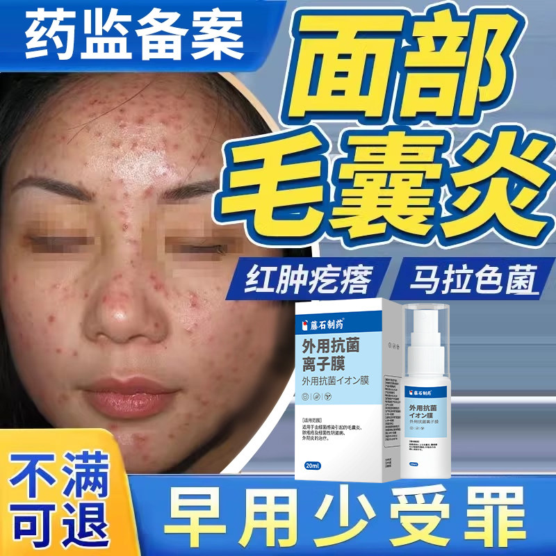 【不满可退】面部毛囊炎脸上痤疮