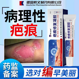 擦伤摔伤点痣掉痂结痂后红印疤痕膏祛疤膏非第一名去疤痕除疤膏OZ
