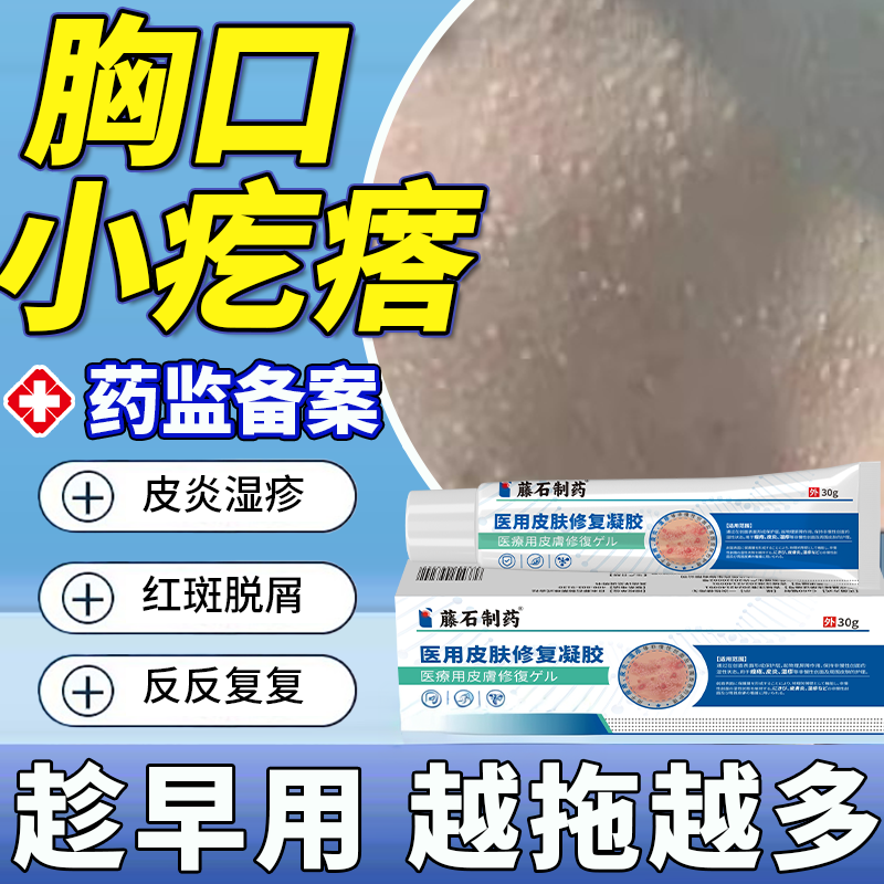 胸口前皮脂腺增生增大小白点疙瘩囊肿丘疹脸上去毛周角化毛囊炎EM