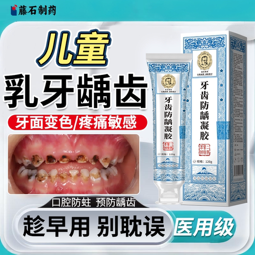 【医用级】乳牙龋齿修复牙膏