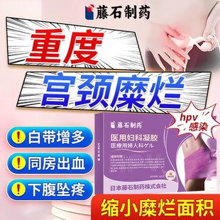 宫颈糜烂重度专用治疗的中药妇科凝胶二度三度消糜栓阴道炎用药OZ