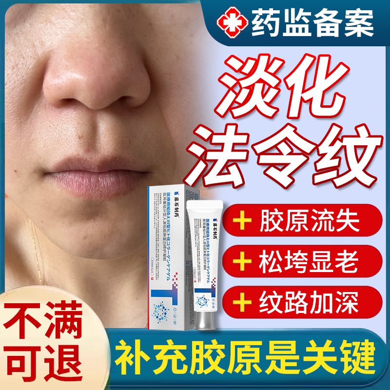 医用胶原蛋白填充修复法令纹凝胶