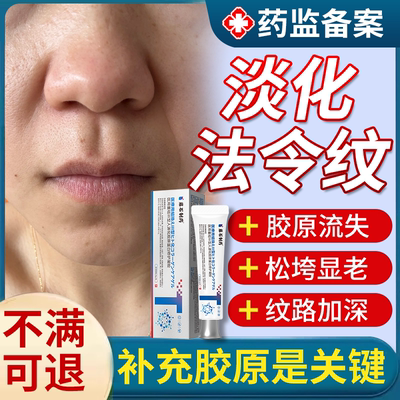 医用胶原蛋白填充修复法令纹凝胶