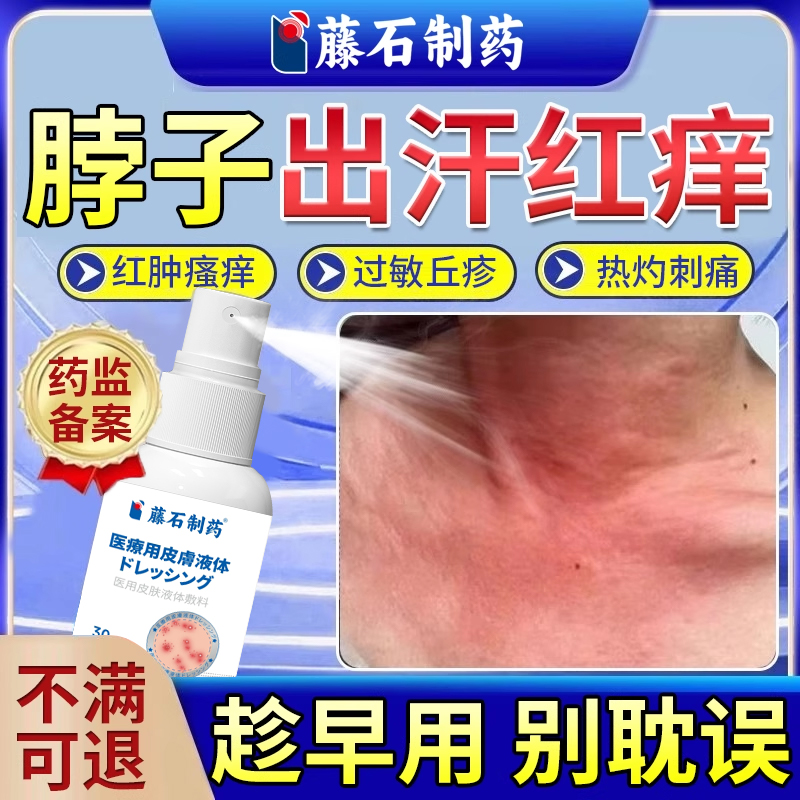 【藤石制药】脖子出汗过敏发红痒