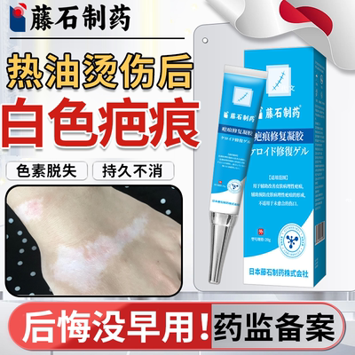 油烫伤后白色疤痕色素脱失凝胶