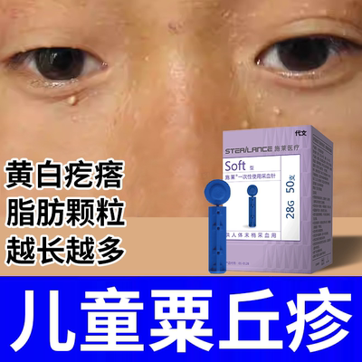 【儿童脸上疙瘩】无菌次抛安全