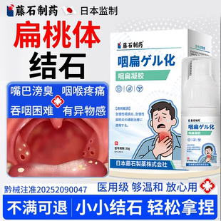 扁桃体炎结石喷剂去除凝胶咽喉肿痛吞咽困难有异物感口臭专用BS