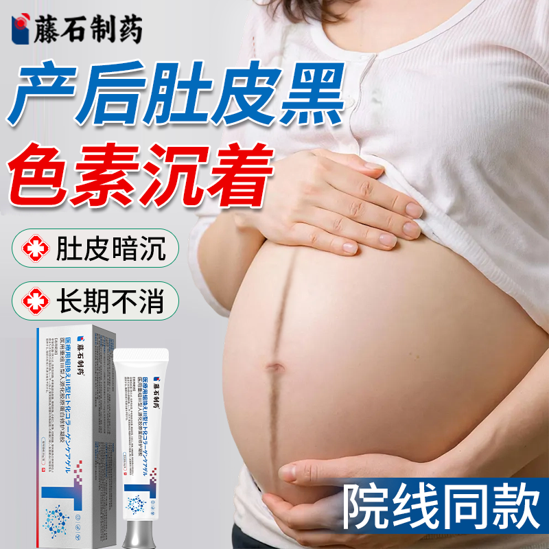 怀孕肚子黑色素沉淀去肚皮妊娠黑线纹淡化黑棘皮美白产后修复霜BS