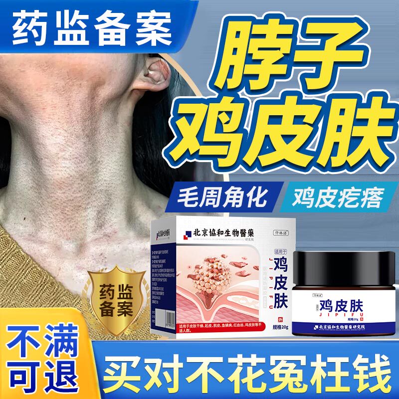 脖子鸡皮肤毛周角化症鸡皮疙瘩毛囊角化毛囊炎毛孔堵塞疏通去除yr