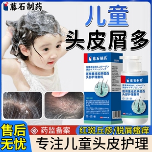 儿童头皮屑严重头皮真菌感染脂溢性皮炎去屑止痒专用洗发水喷剂EM