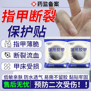 指甲劈了断裂保护贴指甲盖受伤脱落保护套劈裂裂开修复修补护甲EM