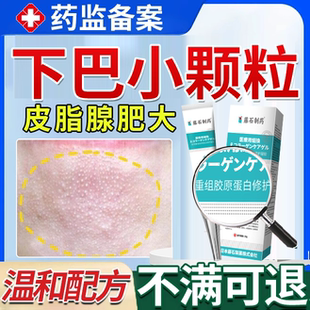 下巴小疙瘩颗粒皮脂腺异位症增生肥大白点长痘闭口脂肪粒粟丘疹OZ