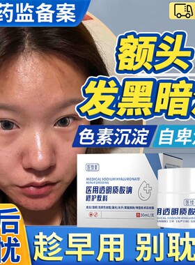 额头黑色素沉着去除凝胶