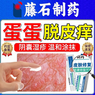 阴囊湿疹潮湿蛋皮蛋蛋瘙痒男人止痒癣私处睾丸干燥搭脱皮药膏OZ