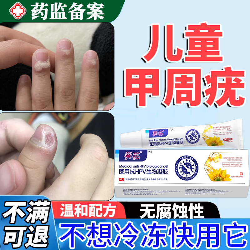 【温和无痛】儿童甲周疣去除膏