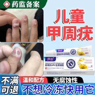 儿童甲周疣寻常疣硬皮瘊子手指长疣去除专用神器根水药房同款膏JW