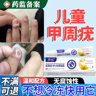 【温和无痛】儿童甲周疣去除膏