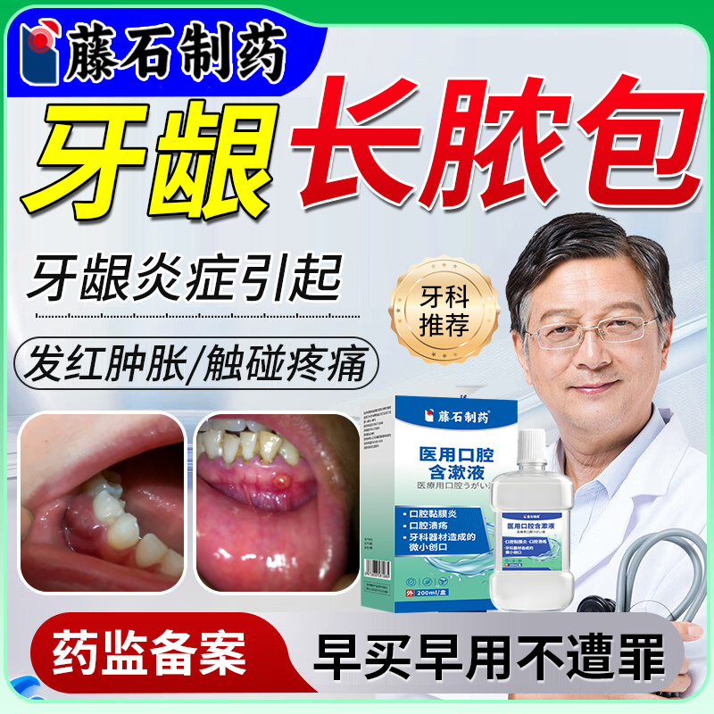 【医用级】牙龈长脓包就用它
