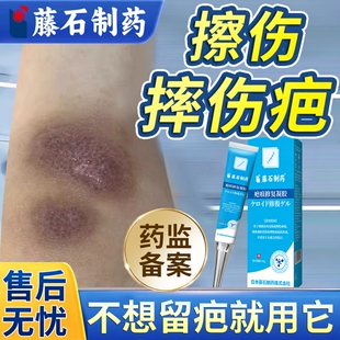 擦伤祛疤膏摔伤破皮愈合修复疤克除脸上膝盖去红印黑疤色素沉淀BS