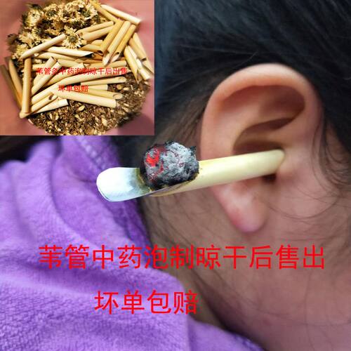耳灸仪专用苇管排灸盒家用随身灸