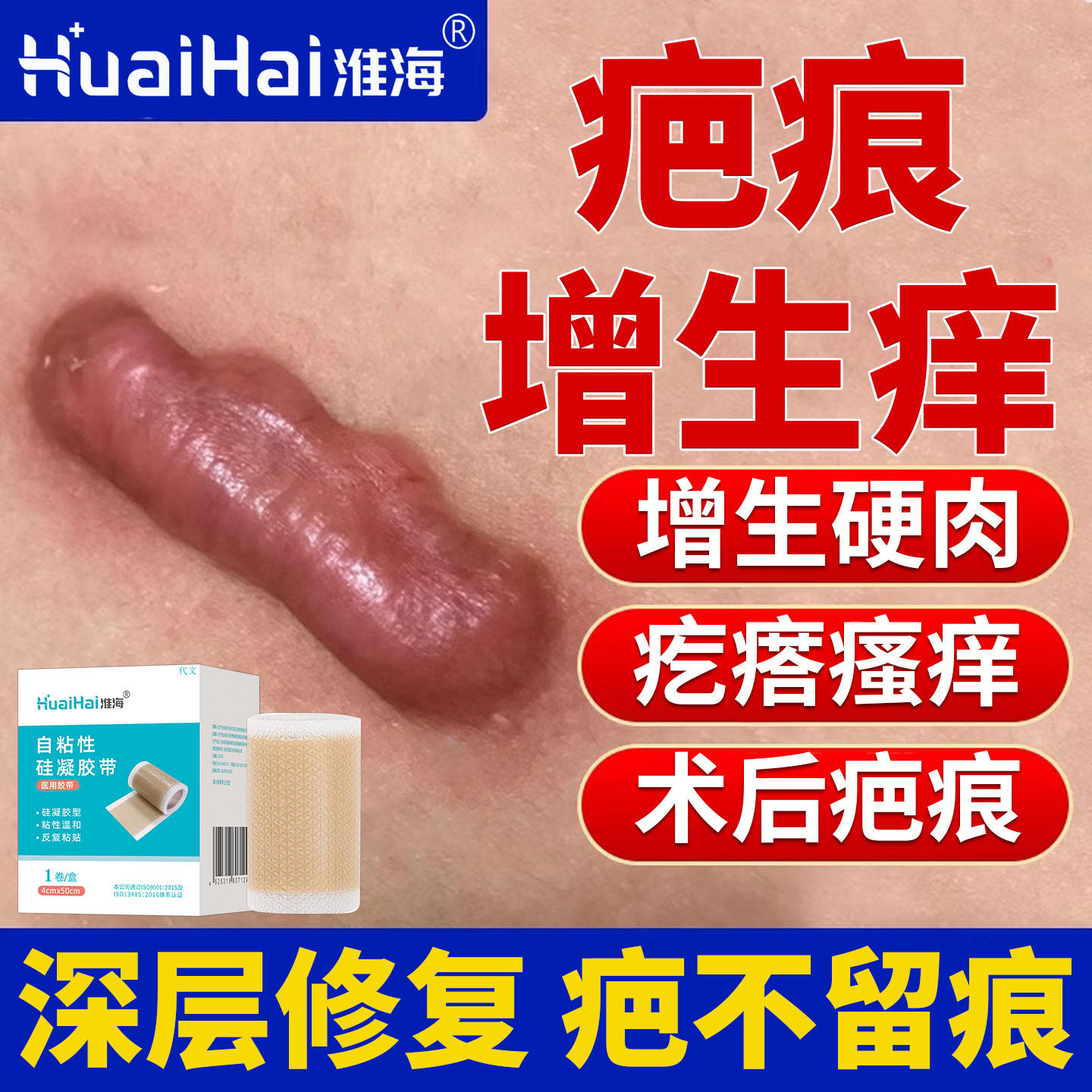 胸口增生疤痕凸起硬肉去除疙瘩止痒软化针止痒乳药膏压力隐形贴YZ
