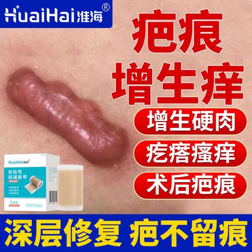 淮海医用硅凝胶增生疤痕凸起硬肉