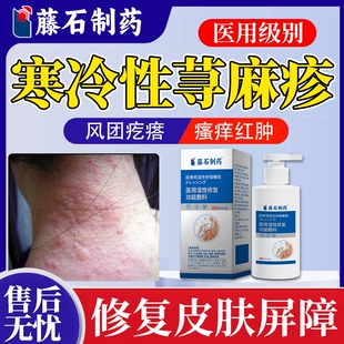 寒冷性荨麻疹过敏止痒断专用沐浴露皂着增强免疫力根药房同款膏YY