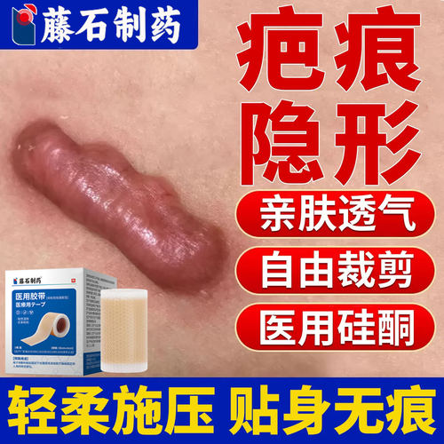 淮海医用硅凝胶增生疤痕凸起硬肉
